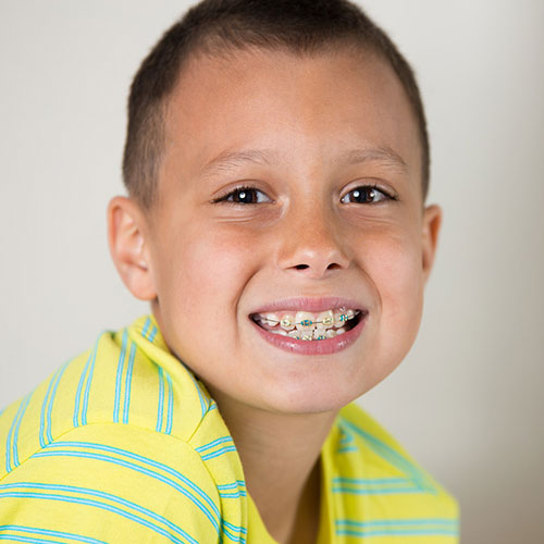 common orthodontic issues